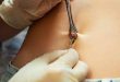 sedute piercing ravvicinate